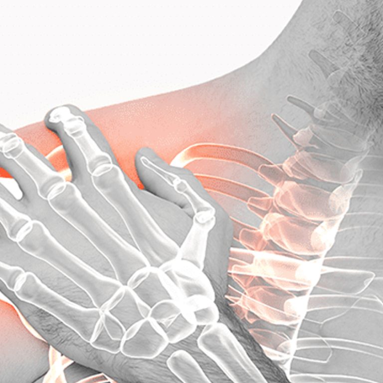 Rotator Cuff Injury